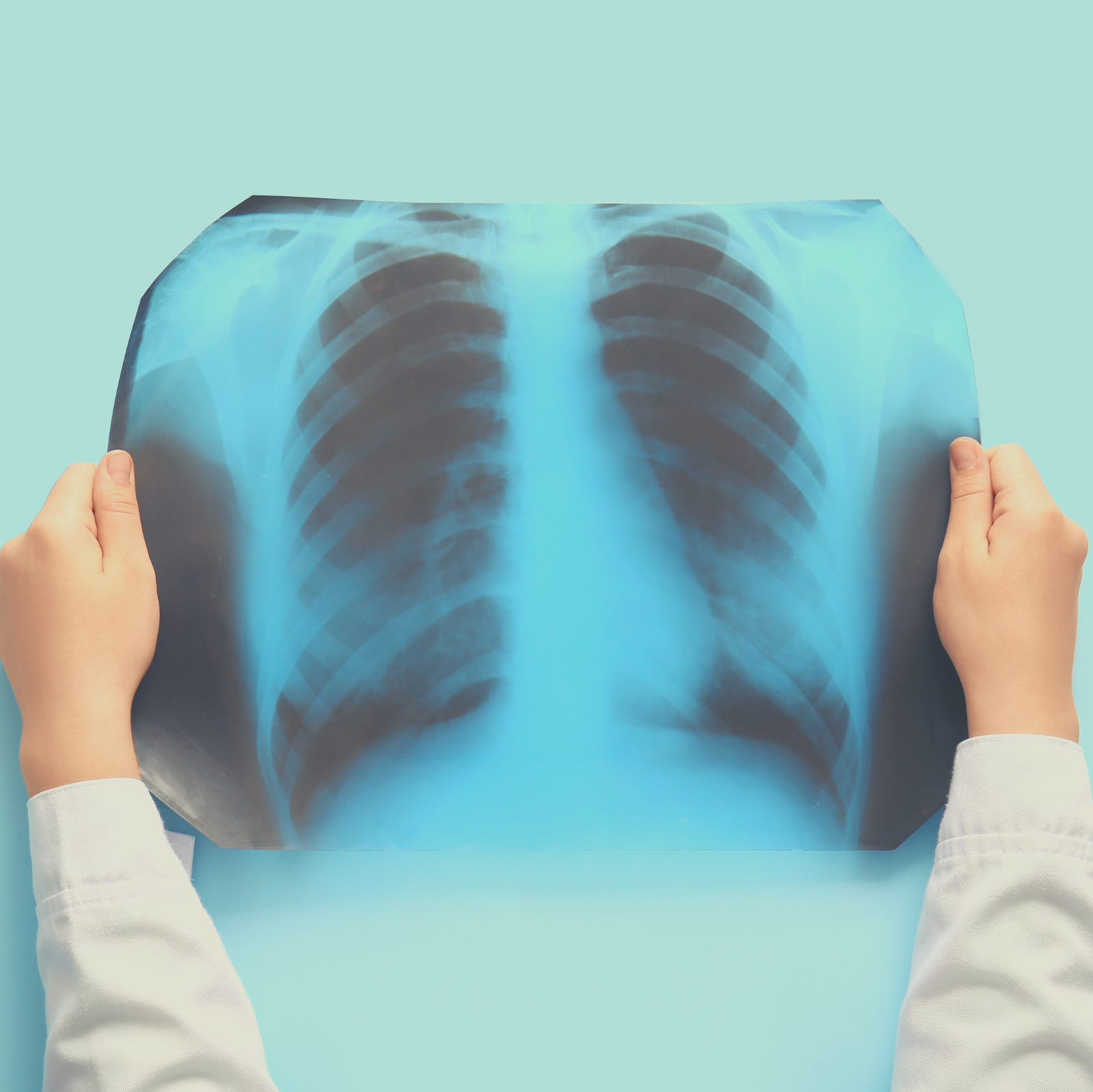 RADIOGRAFIA